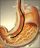 Gastroskopie